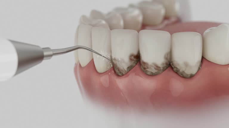 Reliable Dental contractor in Loudonville, OH by Dentist Open Now